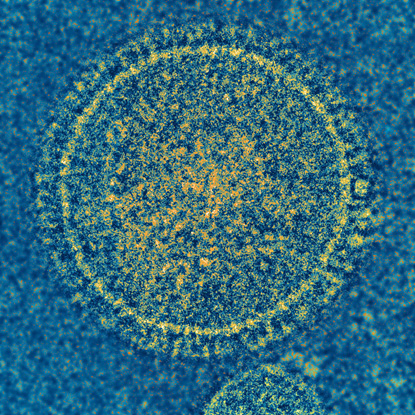 image of the respiratory syncytial virus in blue and yellow