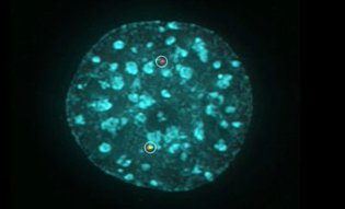 greenish cell with spots