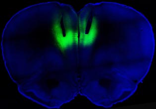 blue image of brain showing prelimbic cortex lit up in green