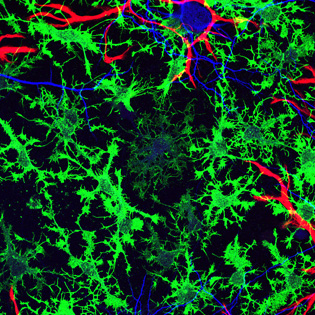 glial cells in the brain