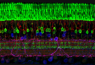 layers of cells; bright green layer on top