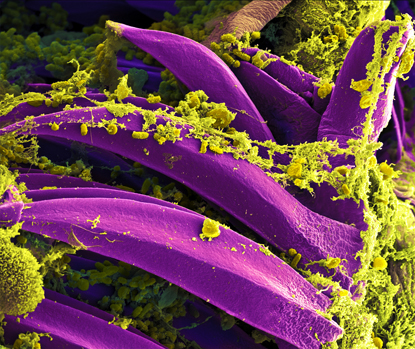 purple banana shapes rearing their heads