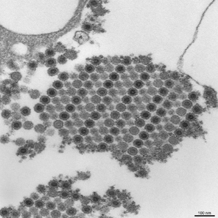 virus particles; image looks like a honey-comb pattern