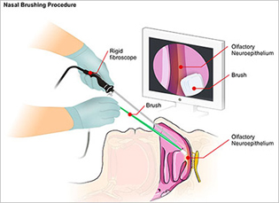 graphic showing gloved hands inserting rhinoscope in patient's nose