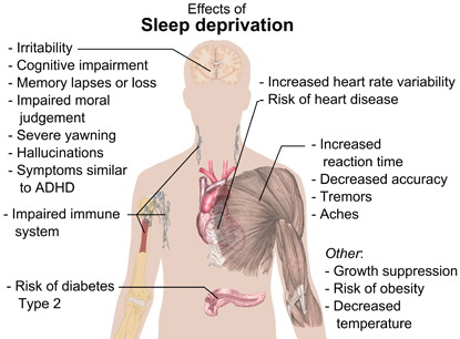 Effects of Acute Sleep Loss On Physical Performance – YLMSportScience