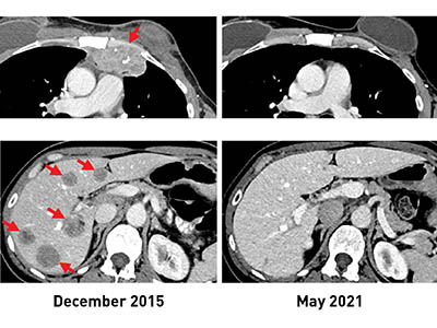 scans showing cross-section of liver