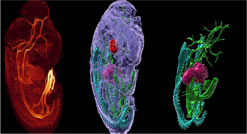 three views of mouse embryo