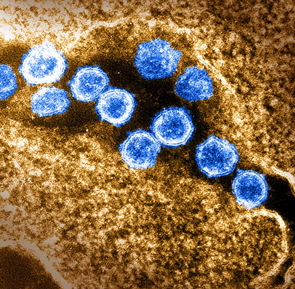 SARS-CoV-2 virus particles