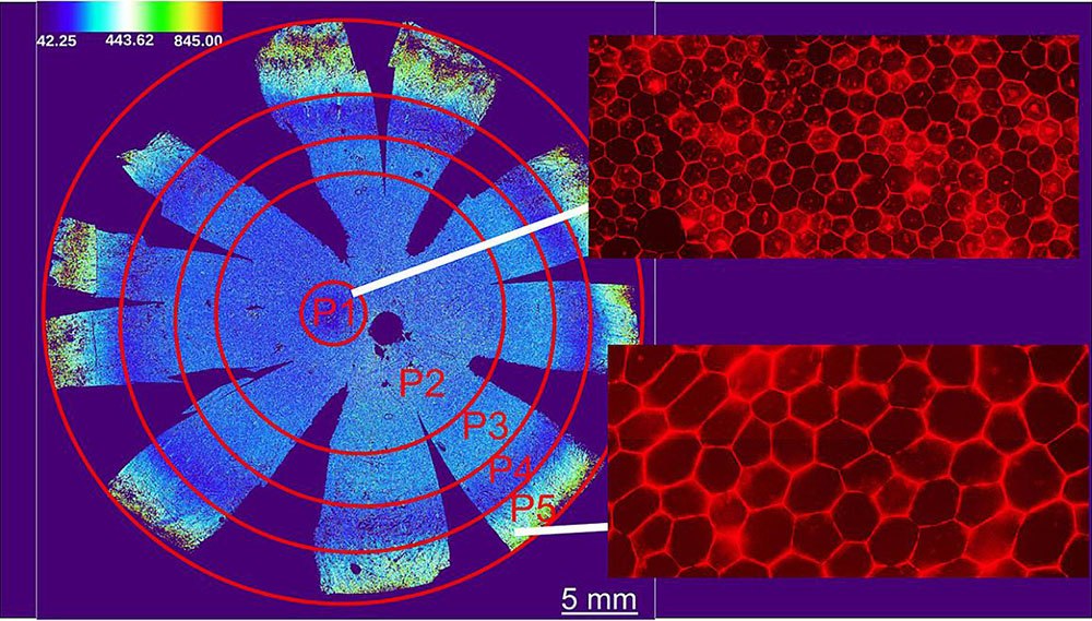 Retinal cell map could advance precise therapies for blinding diseases