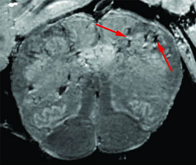 black and white cross section of brain