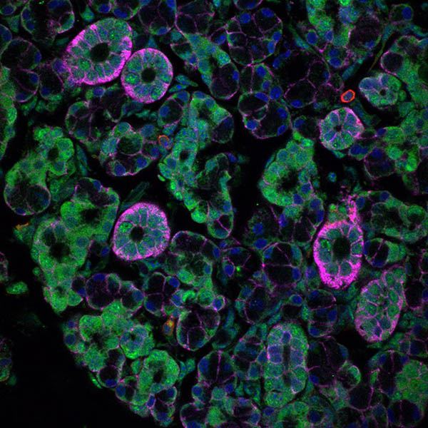 IRP scientists discover norovirus and other “stomach viruses” can spread through saliva