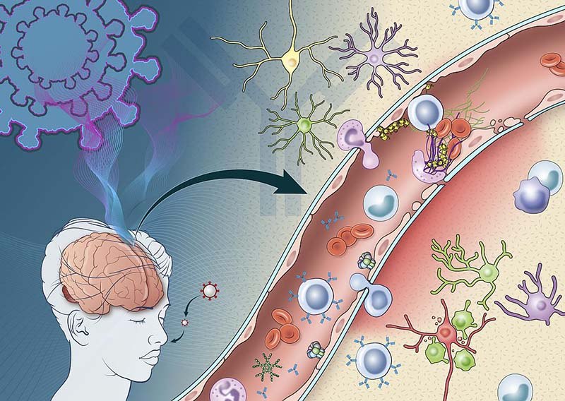 Small NIH study reveals how immune response triggered by COVID-19 may damage the brain