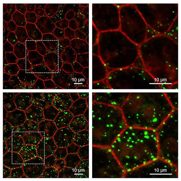 IRP study finds loss of ‘youth’ protein may drive aging in the eye