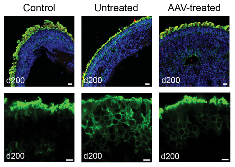 IRP researchers develop gene therapy for rare ciliopathy