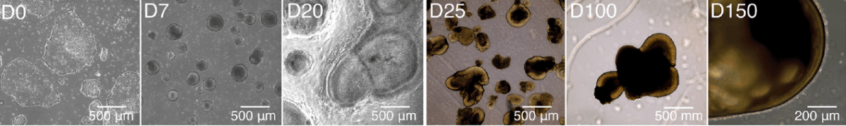 stem cell technology to cure eye diseases research paper