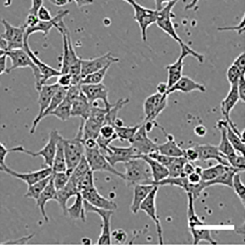 stem cell technology to cure eye diseases research paper