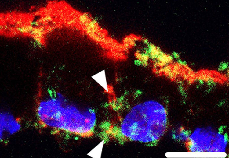 A cross section of the stem-cell generated RPE is shown after it has been fed photoreceptor outer segments. Arrows point to lipid deposits (green). This buildup of lipids is toxic to the cell, and similar to that seen in patients with Stargardt disease.