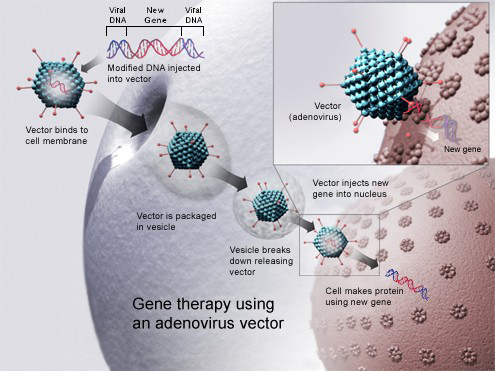 diagram showing how a virus can be used to deliver a new gene to a cell for gene therapy