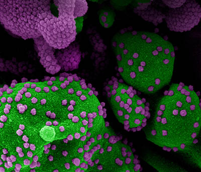 green cell peppered with purple virus particles