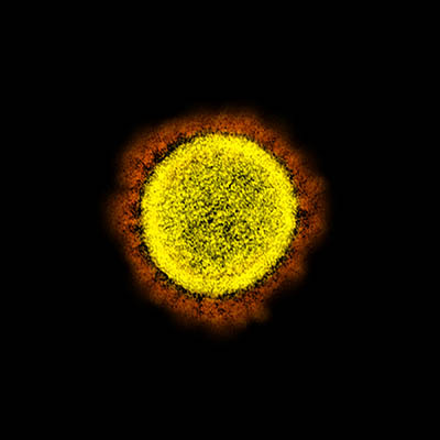coronavirus image-yellow sunlike sphere with orange rays all around