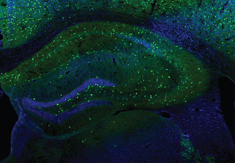 Interneurons (green) in the hippocampus of a mouse
