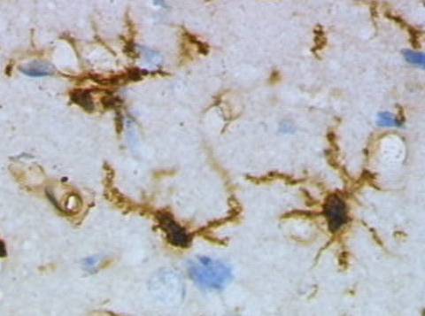 microglia