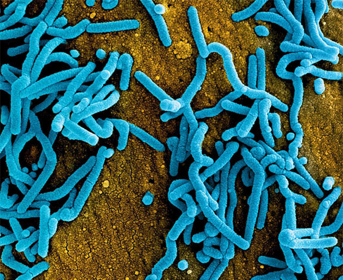Colorized scanning electron micrograph of Marburg virus particles (blue) both budding and attached to the surface of infected VERO E6 cells (orange)