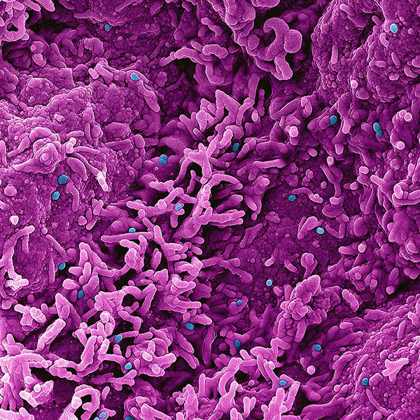 Colorized scanning electron micrograph of monkeypox virus (blue) on the surface of infected VERO E6 cells (pink)