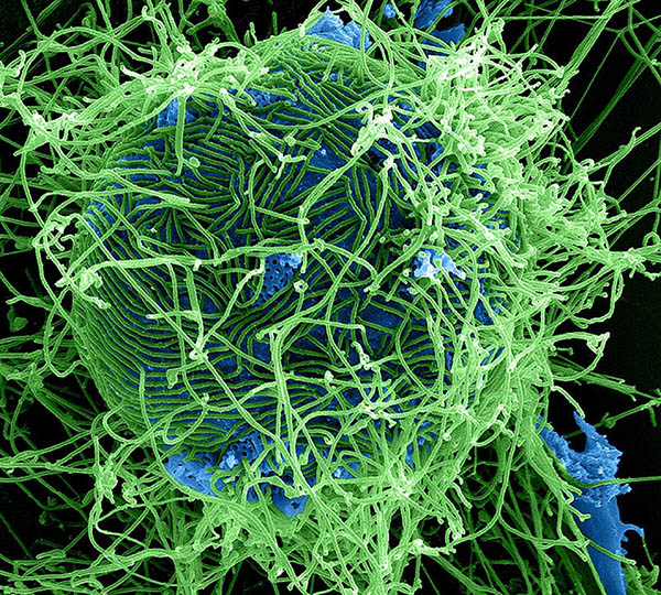 Colorized scanning electron micrograph of filamentous Ebola virus particles (green) attached to and budding from a chronically infected VERO E6 cell (blue) (25,000x magnification)