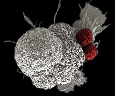 T cells (red) attacking cancer cell (white)