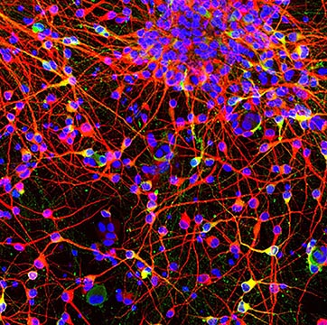 cells that look like fireworks