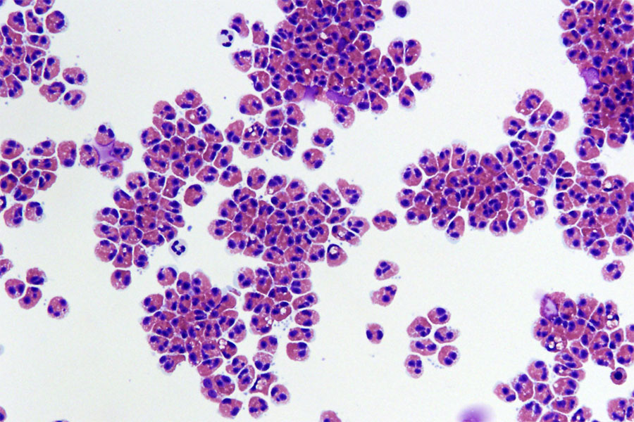 human eosinophil cells