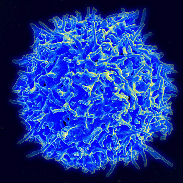 Scanning electron micrograph of a human T cell from the immune system of a healthy donor