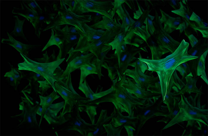 fibroblast cells with nuclei shown in blue
