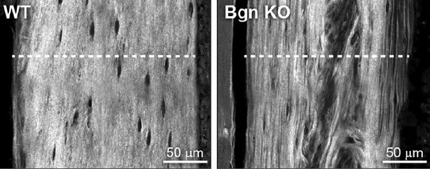 At six weeks of age, the bones of mice without biglycan (right) had structural abnormalities that made them weaker than the bones of genetically normal mice (left)