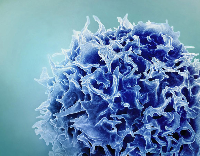 Colorized scanning electron micrograph of a T lymphocyte (also known as a T cell)