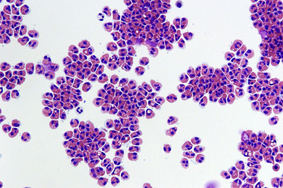human eosinophils as seen under a microscope