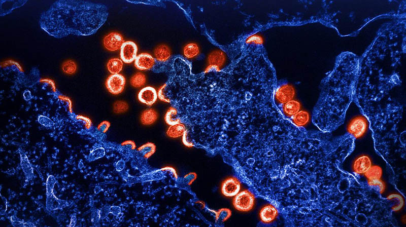 Transmission electron micrograph of HIV-1 virus particles (red) budding and replicating from a segment of a chronically infected H9 cell (blue)