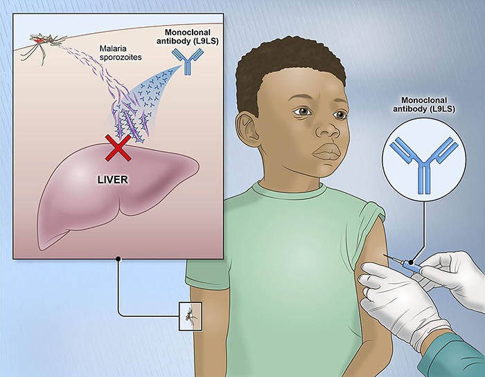 child receiving monoclonal antibody injection