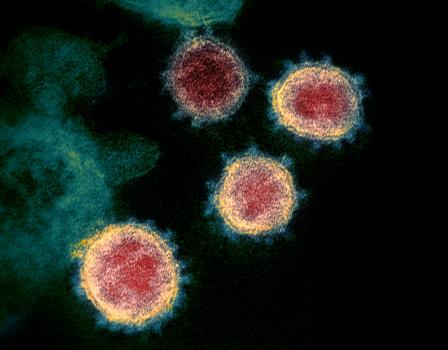 SARS-CoV-2 virus particles