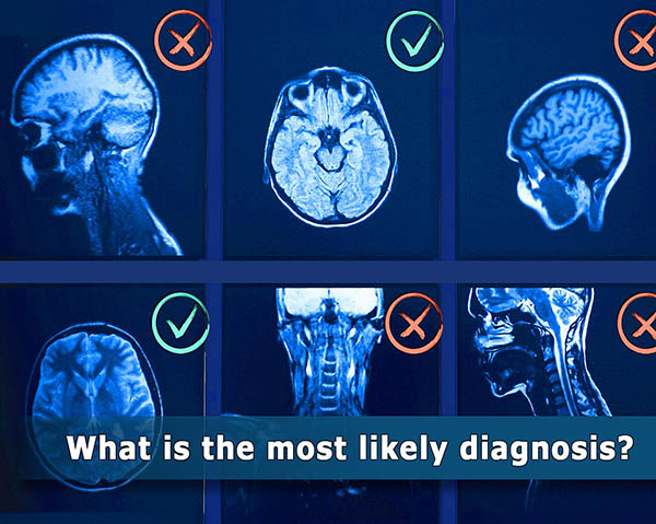 brain MRI images