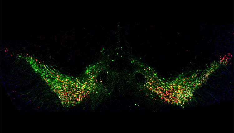 Tyrosine Hydroxylase (TH) positive dopaminergic neurons in the brain's substantia nigra