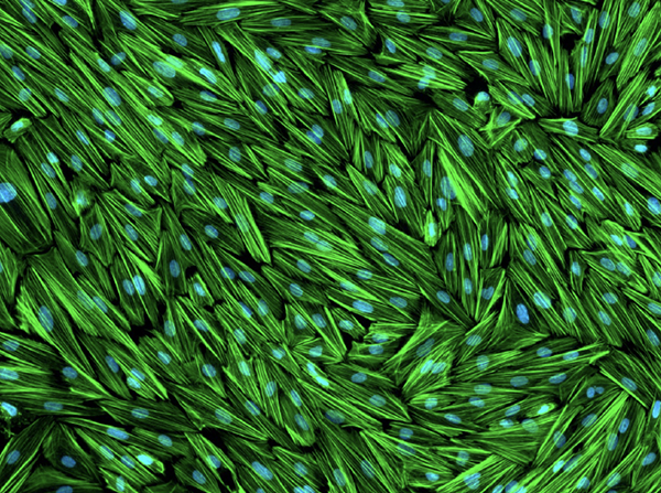 Human endometrial stromal cells
