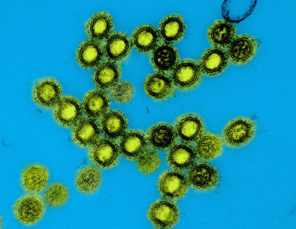 Colorized transmission electron micrograph of influenza A/H1N1 virus particles