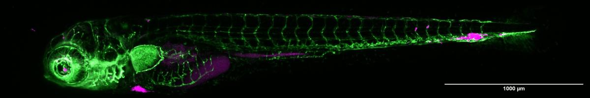 Micrograph showing zebrafish blood vessels in green and introduced human tumor cells in magenta