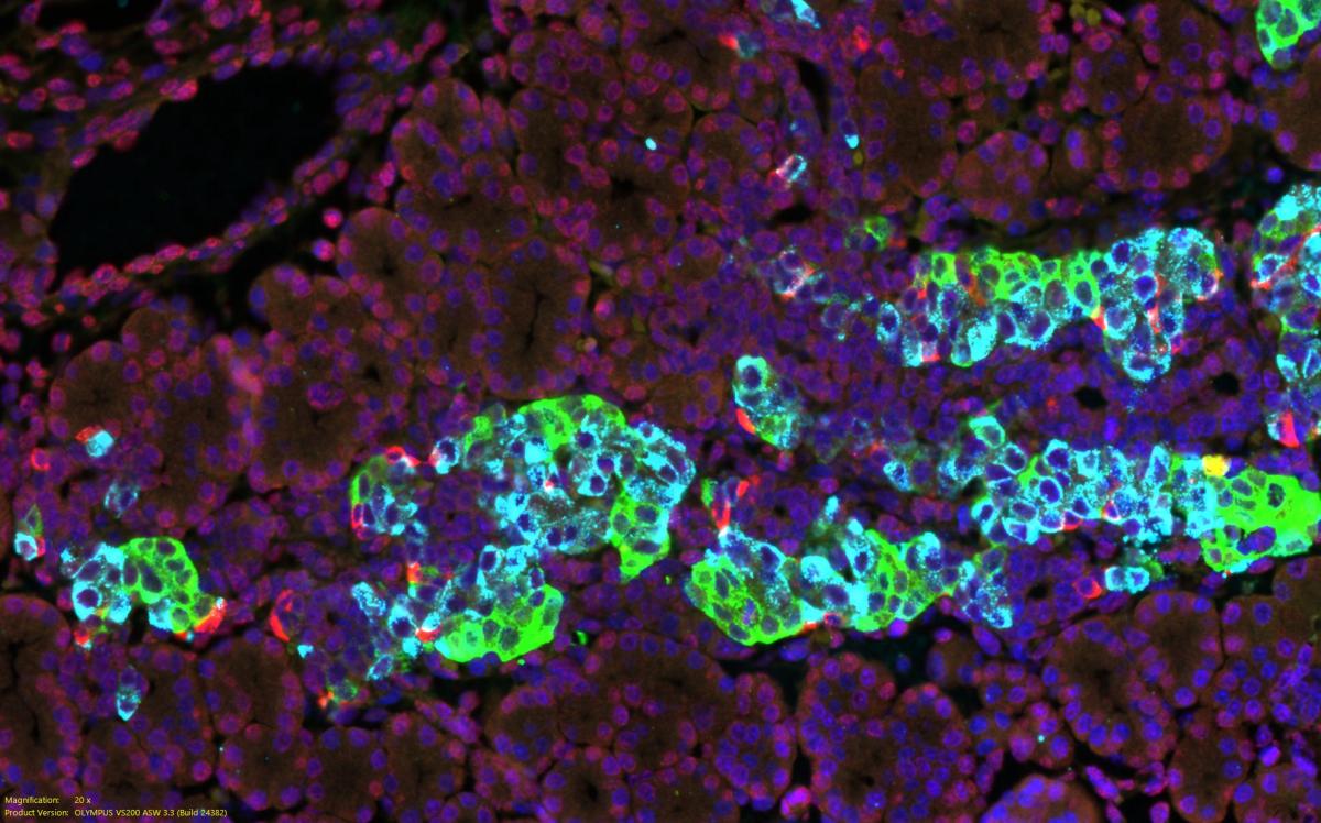blue and green pancreatic cells surrounded by purple cells