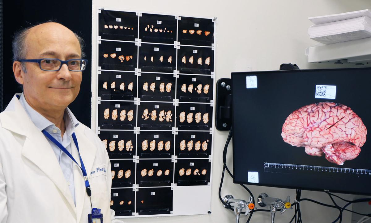 Dr. Stefano Marenco, acting Director of the Human Brain Collection Core