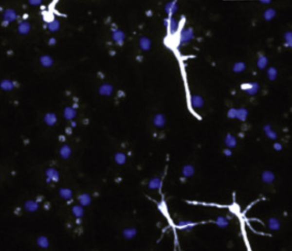 neurons (white) grown from neural stem cells