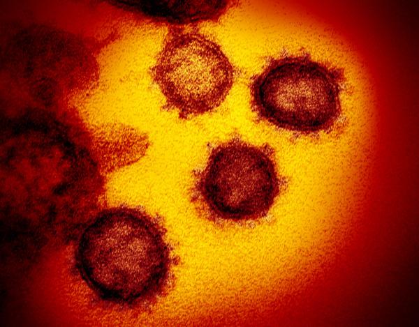 coronavirus in a patient sample