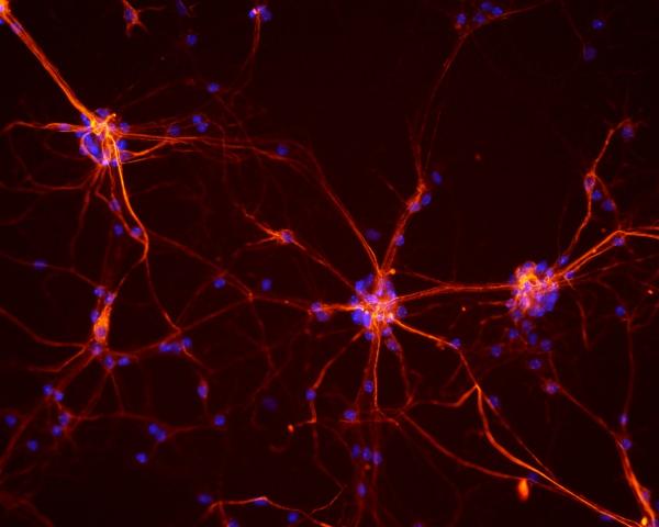 mouse spinal cord neurons